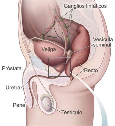 Cómo desinflamar la próstata según el médico naturista Dr. Manuel Lezaeta